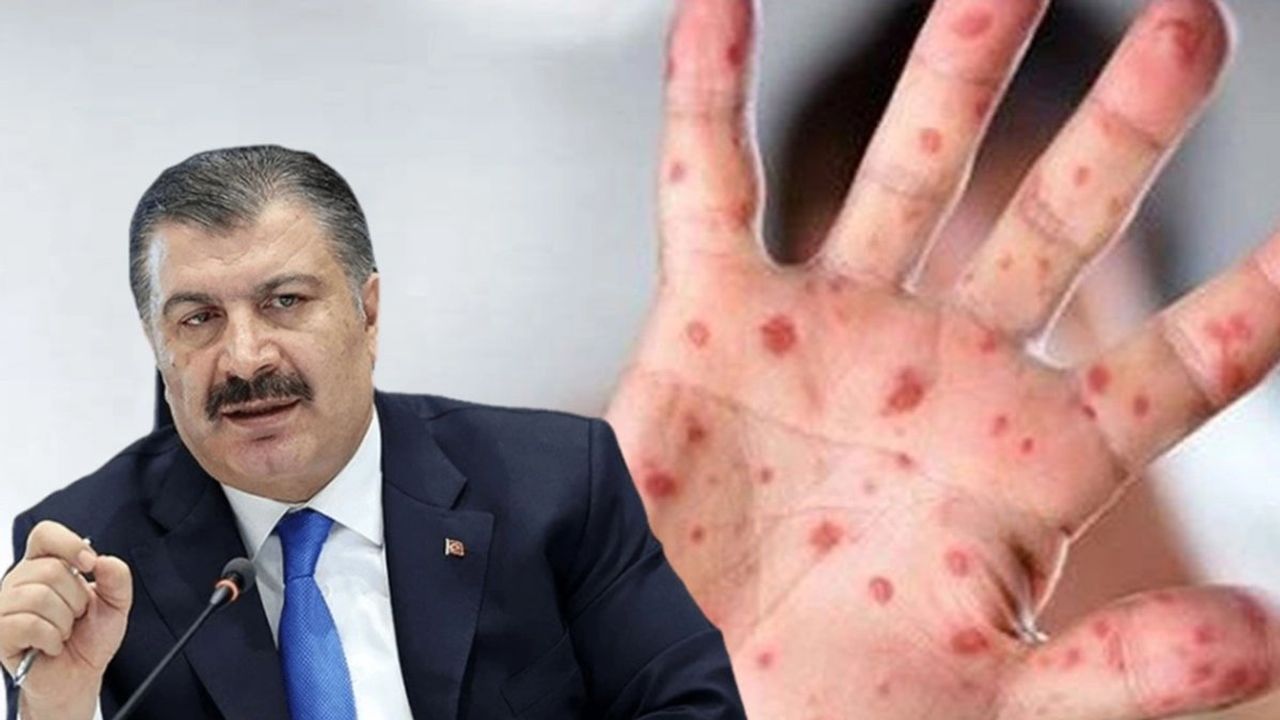Sağlık Bakanı Fahrettin Koca'dan Kızamık Açıklaması
