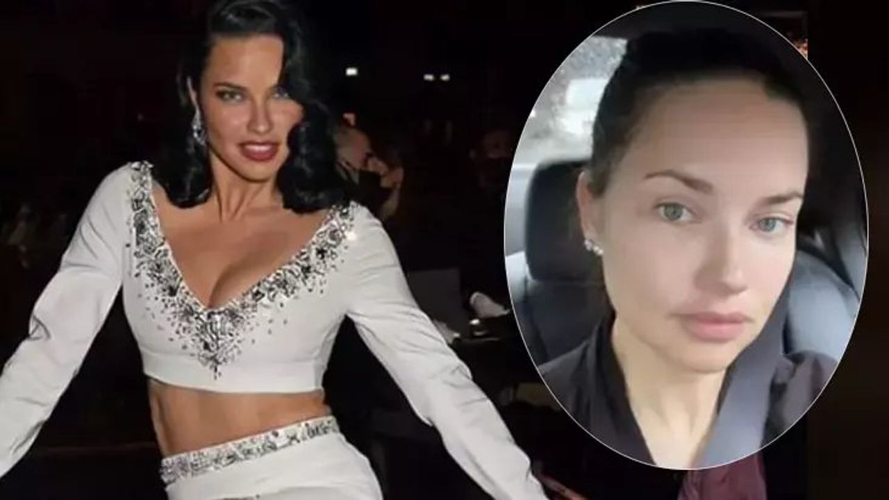 Adriana Lima Paris Moda Haftası'nda Tahtakurusu İstilasıyla Karşılaştı