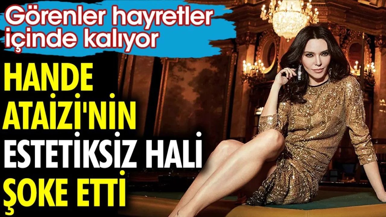 Hande Ataizi'nin Estetiksiz Hali Şoke Etti!