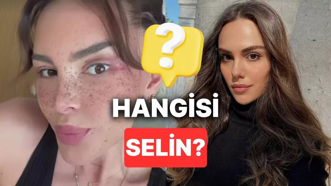 Selin Ciğerci Badem Göz Ameliyatı Oldu