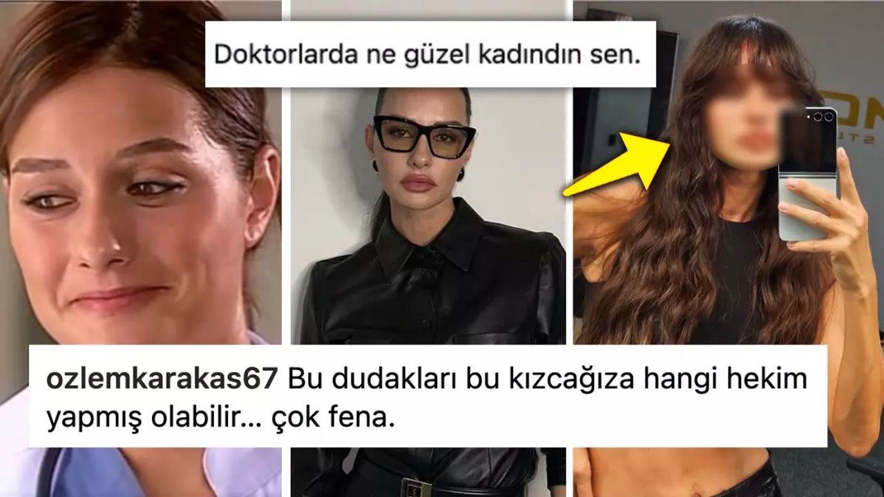 Yasemin Özilhan'ın dudakları sosyal medyada gündem oldu