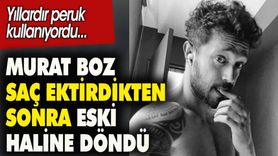 Murat Boz Saçlarını Ektirdi: Son Hali Nasıl?