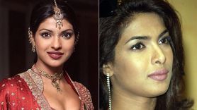 Priyanka Chopra: Bollywood'dan Hollywood'a Yolculuğu ve Burun Ameliyatının Getirdiği Zorluklar