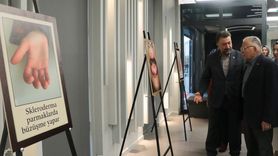 Kayseri'de Romatizmal Hastalıkların Görselleştirilmesi