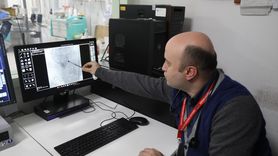 Samsun'da Nadir Görülen 4 Yaprakçıklı Aort Kapağı Ameliyatı Başarıyla Gerçekleştirildi