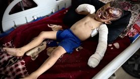 Minik Ahmed'in Dramı: Gazze'de Saldırıların Yüzü