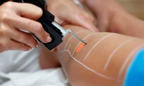 Epilasyoncu Ünlü Şarkıcının Kızlarını Yaktı