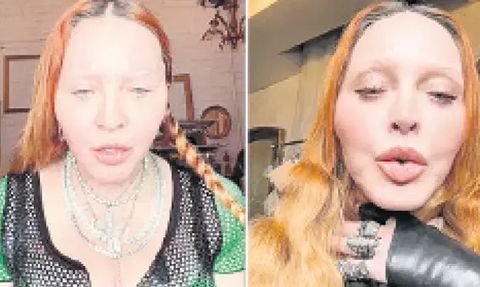 Madonna'nın Filtresiz Videosu Hayranlarını Endişelendirdi