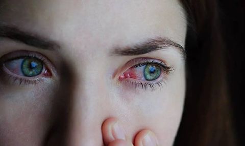 Gözlerinde Bu Belirtiler Varsa Dikkat Edin! Ani Ölüme Bile Yol Açabiliyor...