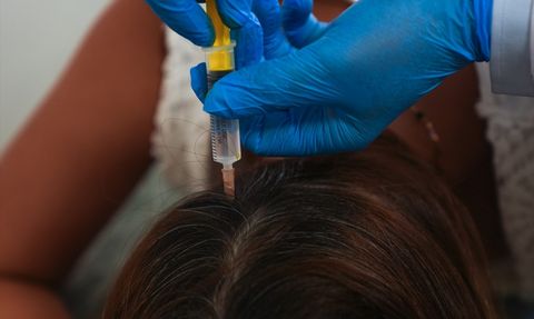 Sinir Blokajı Yöntemi ile Migrenle Mücadele