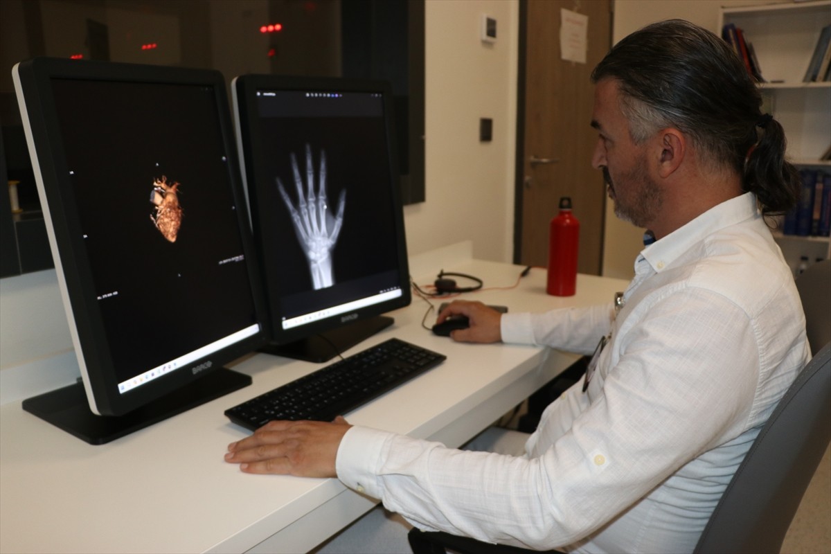 Kütahya'da sadece sol el röntgeninden çocuk ve erişkinlerde kemik yaşı ve cinsiyet belirleyen...