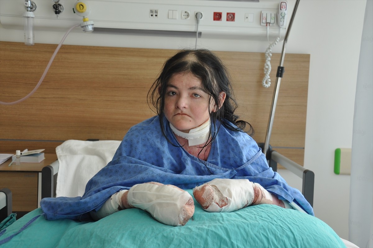 Halk arasında "kelebek hastalığı" olarak bilinen "epidermolysis bullosa (EB)" hastası 20 yaşındaki...